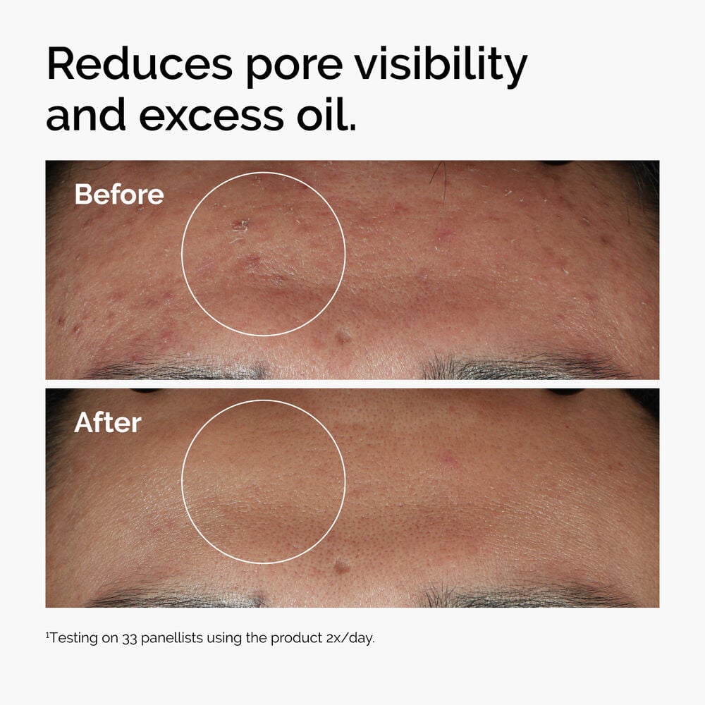 Niacinamide 10% + Zinc 1% Oil Control Serum - Image 4